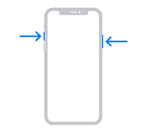 Botones laterales del iPhone